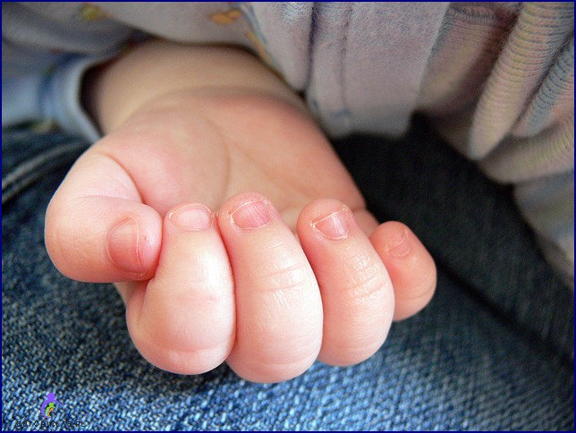 Obgryzanie paznokci u dzieci Jak oduczyć dziecko obgryzania paznokci
