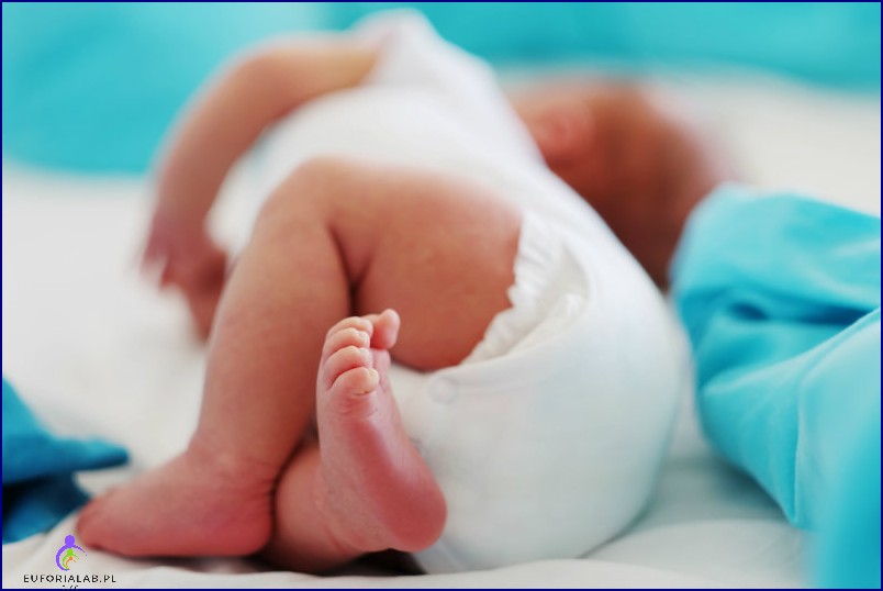 Odparzenia pieluszkowe czy alergia Sprawdź co dolega niemowlęciu
